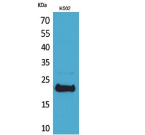 Western blot - LIF Polyclonal Antibody from Signalway Antibody (41551) - Antibodies.com