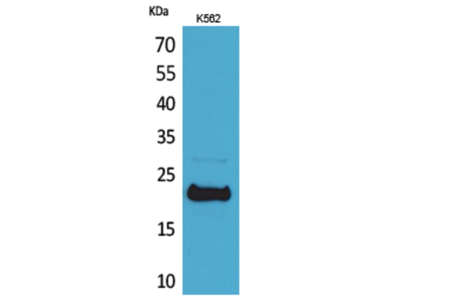 Western blot - LIF Polyclonal Antibody from Signalway Antibody (41551) - Antibodies.com