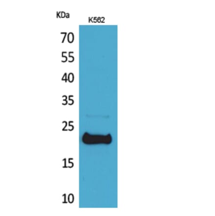 Western blot - LIF Polyclonal Antibody from Signalway Antibody (41551) - Antibodies.com