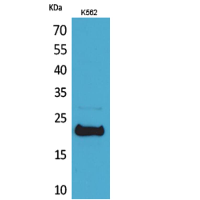 Western blot - LIF Polyclonal Antibody from Signalway Antibody (41551) - Antibodies.com