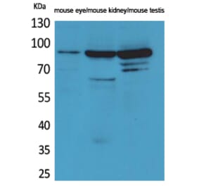 Western blot - Hrs Polyclonal Antibody from Signalway Antibody (41566) - Antibodies.com