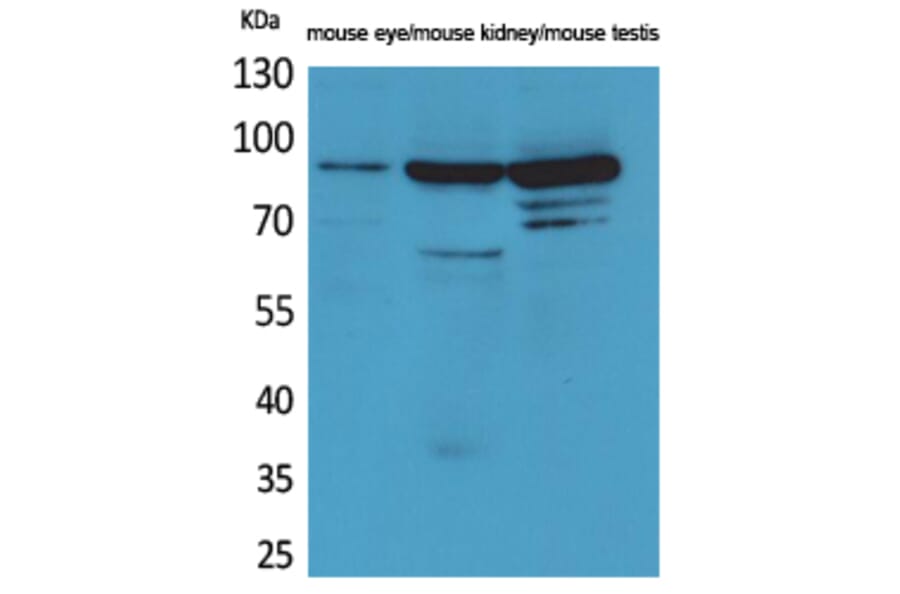 Western blot - Hrs Polyclonal Antibody from Signalway Antibody (41566) - Antibodies.com