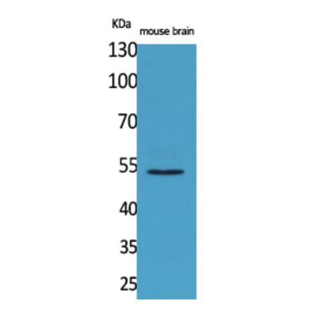 Western blot - CPE Polyclonal Antibody from Signalway Antibody (41578) - Antibodies.com