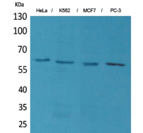Western blot - p63 Polyclonal Antibody from Signalway Antibody (41592) - Antibodies.com