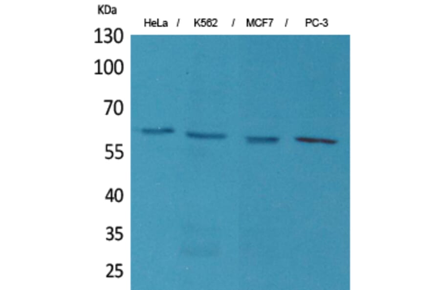 Western blot - p63 Polyclonal Antibody from Signalway Antibody (41592) - Antibodies.com