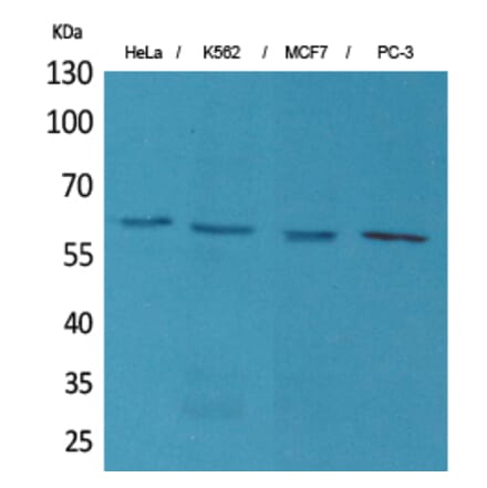 Western blot - p63 Polyclonal Antibody from Signalway Antibody (41592) - Antibodies.com
