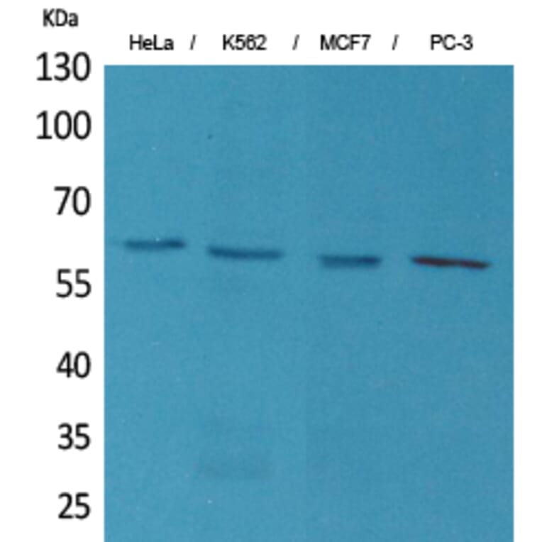 Western blot - p63 Polyclonal Antibody from Signalway Antibody (41592) - Antibodies.com