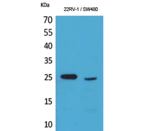 Western blot - SSX Polyclonal Antibody from Signalway Antibody (41594) - Antibodies.com