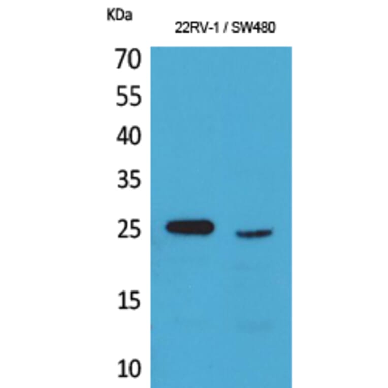 Western blot - SSX Polyclonal Antibody from Signalway Antibody (41594) - Antibodies.com