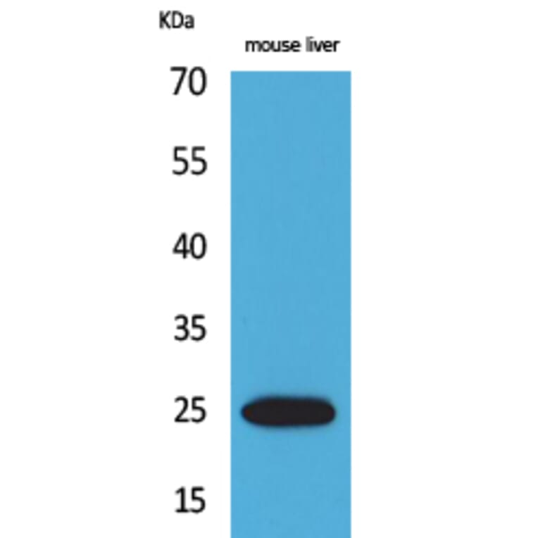 Western blot - CRP Polyclonal Antibody from Signalway Antibody (41605) - Antibodies.com