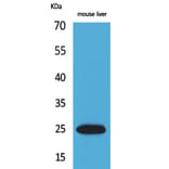 Western blot - CRP Polyclonal Antibody from Signalway Antibody (41605) - Antibodies.com