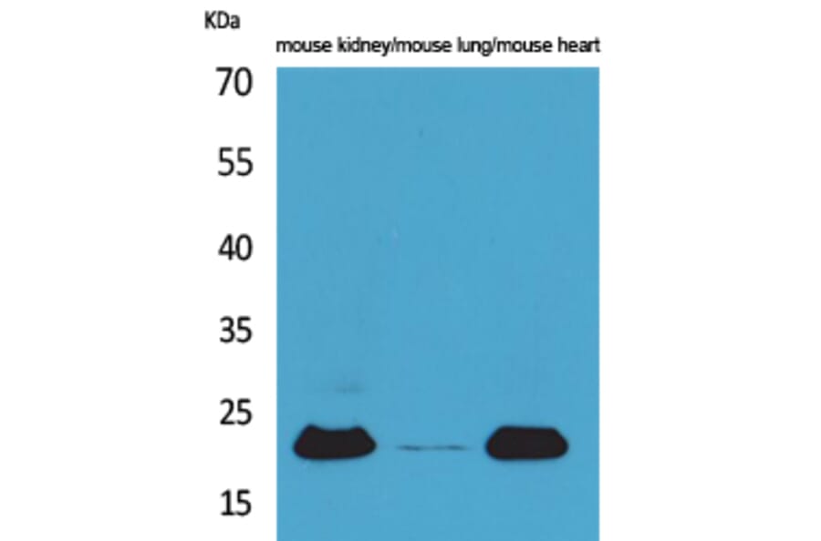 Western blot - ADM Polyclonal Antibody from Signalway Antibody (41611) - Antibodies.com