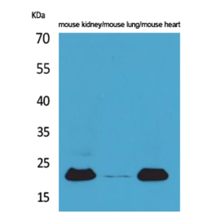 Western blot - ADM Polyclonal Antibody from Signalway Antibody (41611) - Antibodies.com