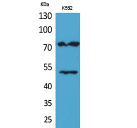 Western blot - HDC Polyclonal Antibody from Signalway Antibody (41633) - Antibodies.com