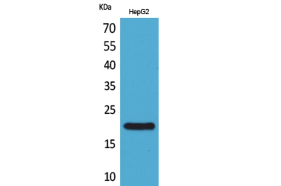 Western blot - VHR Polyclonal Antibody from Signalway Antibody (41636) - Antibodies.com