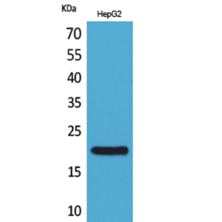 Western blot - VHR Polyclonal Antibody from Signalway Antibody (41636) - Antibodies.com