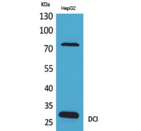 Western blot - DCI Polyclonal Antibody from Signalway Antibody (41637) - Antibodies.com