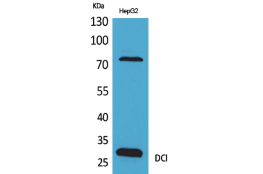 Western blot - DCI Polyclonal Antibody from Signalway Antibody (41637) - Antibodies.com