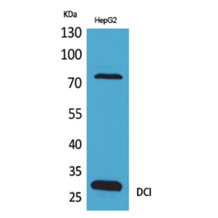 Western blot - DCI Polyclonal Antibody from Signalway Antibody (41637) - Antibodies.com