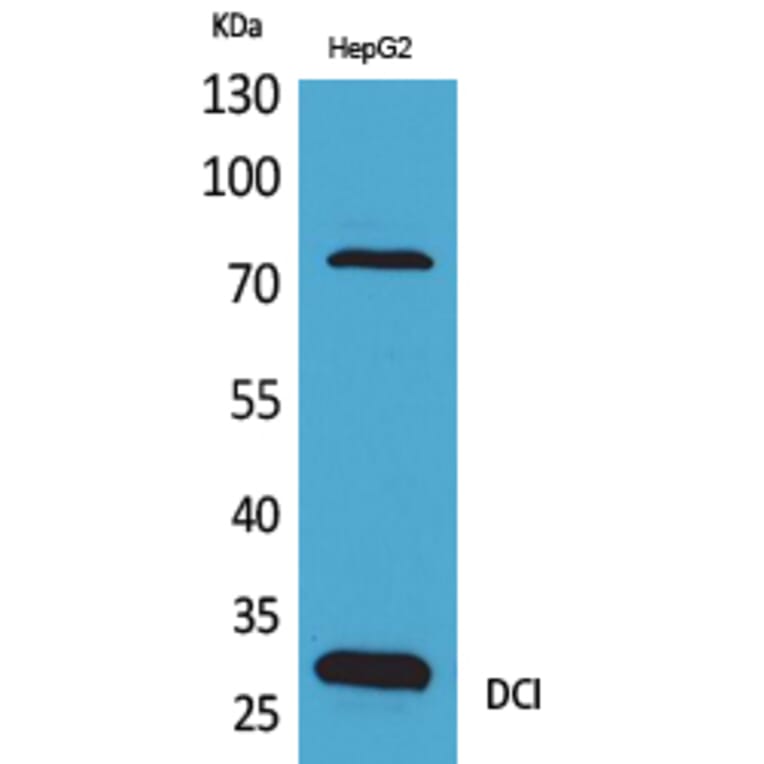 Western blot - DCI Polyclonal Antibody from Signalway Antibody (41637) - Antibodies.com