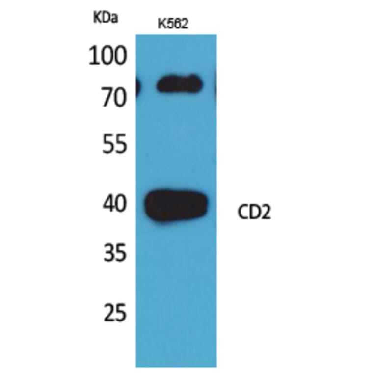 Western blot - CD2 Polyclonal Antibody from Signalway Antibody (41648) - Antibodies.com