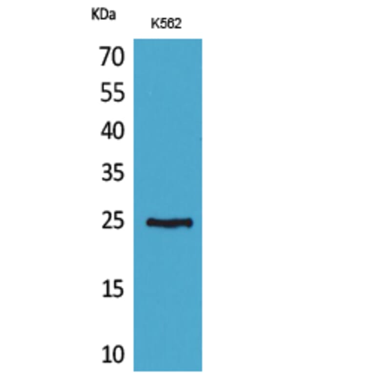 Western blot - CD7 Polyclonal Antibody from Signalway Antibody (41649) - Antibodies.com