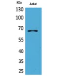 Western blot - ERα Polyclonal Antibody from Signalway Antibody (41717) - Antibodies.com