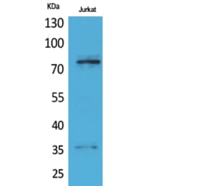 Western blot - p73 Polyclonal Antibody from Signalway Antibody (41736) - Antibodies.com