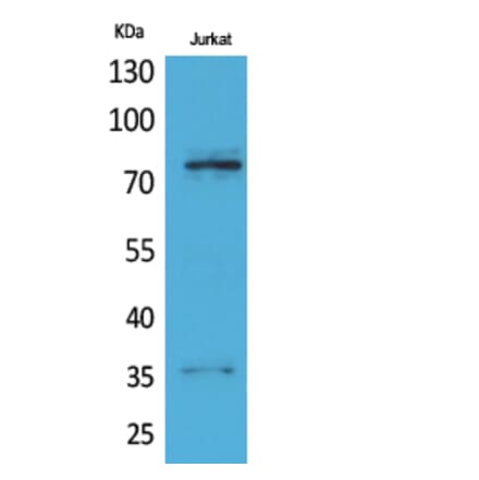 Western blot - p73 Polyclonal Antibody from Signalway Antibody (41736) - Antibodies.com