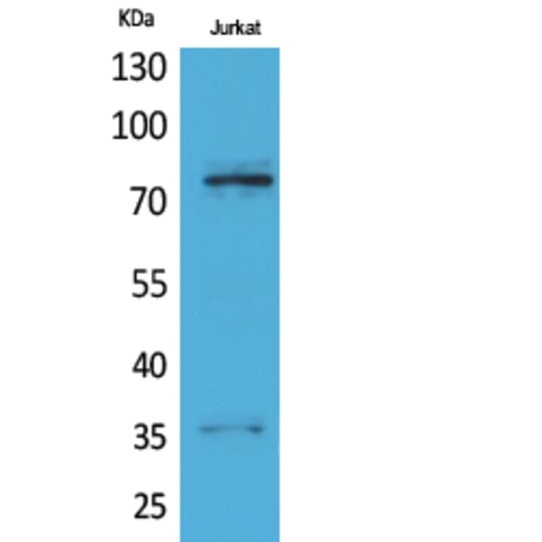 Western blot - p73 Polyclonal Antibody from Signalway Antibody (41736) - Antibodies.com