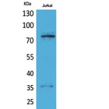 Western blot - p73 Polyclonal Antibody from Signalway Antibody (41736) - Antibodies.com