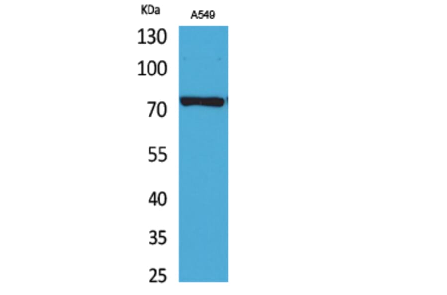 Western blot - p73 Polyclonal Antibody from Signalway Antibody (41737) - Antibodies.com