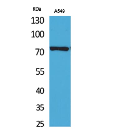Western blot - p73 Polyclonal Antibody from Signalway Antibody (41737) - Antibodies.com