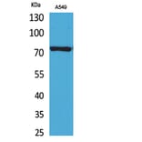 Western blot - p73 Polyclonal Antibody from Signalway Antibody (41737) - Antibodies.com