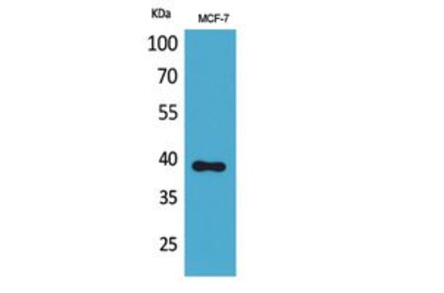 Western blot - Nov Polyclonal Antibody from Signalway Antibody (41797) - Antibodies.com