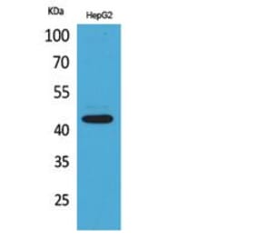 Western blot - EP1 Polyclonal Antibody from Signalway Antibody (41823) - Antibodies.com