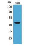 Western blot - EP1 Polyclonal Antibody from Signalway Antibody (41823) - Antibodies.com