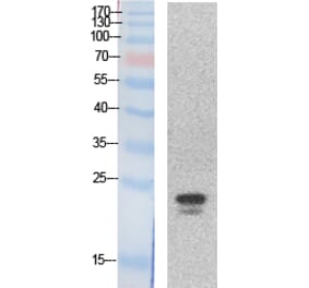 Western blot - SRY Polyclonal Antibody from Signalway Antibody (41868) - Antibodies.com