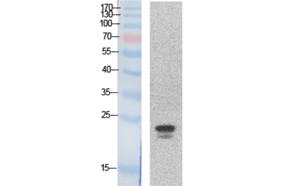 Western blot - SRY Polyclonal Antibody from Signalway Antibody (41868) - Antibodies.com