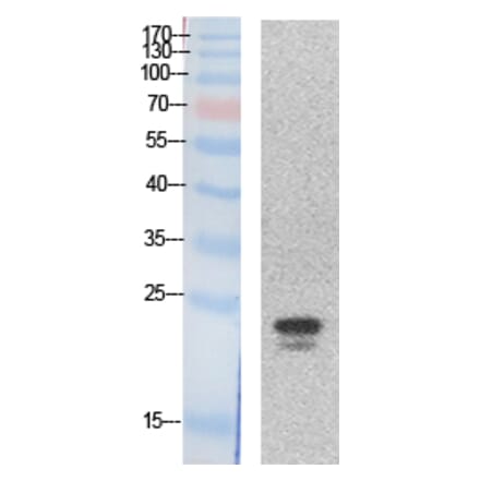 Western blot - SRY Polyclonal Antibody from Signalway Antibody (41868) - Antibodies.com