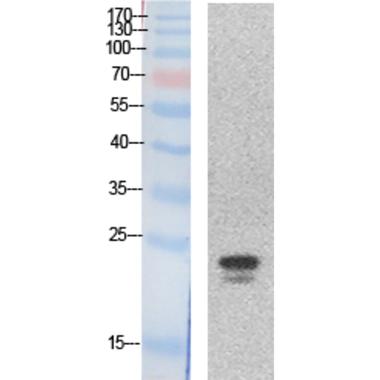 Western blot - SRY Polyclonal Antibody from Signalway Antibody (41868) - Antibodies.com