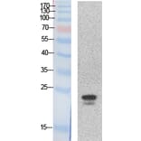 Western blot - SRY Polyclonal Antibody from Signalway Antibody (41868) - Antibodies.com