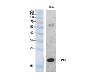 Western blot - PTN Polyclonal Antibody from Signalway Antibody (41889) - Antibodies.com