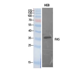 Western blot - FAS Polyclonal Antibody from Signalway Antibody (41895) - Antibodies.com