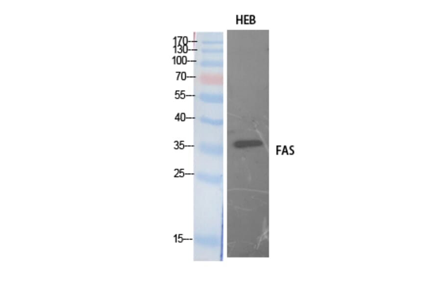 Western blot - FAS Polyclonal Antibody from Signalway Antibody (41895) - Antibodies.com
