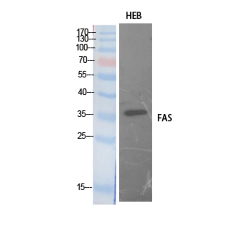 Western blot - FAS Polyclonal Antibody from Signalway Antibody (41895) - Antibodies.com