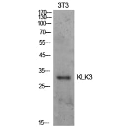 Western blot - PSA Polyclonal Antibody from Signalway Antibody (41917) - Antibodies.com