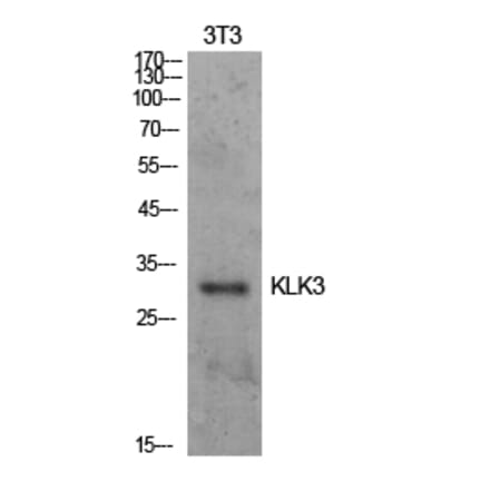 Western blot - PSA Polyclonal Antibody from Signalway Antibody (41917) - Antibodies.com