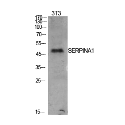 Western blot - AAT Polyclonal Antibody from Signalway Antibody (41927) - Antibodies.com