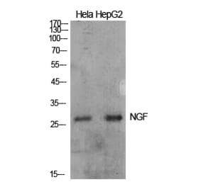 Western blot - NGF Polyclonal Antibody from Signalway Antibody (41931) - Antibodies.com